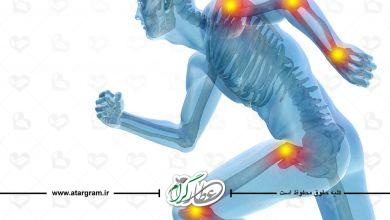 رژيم درماني دردهاي رماتيسمي