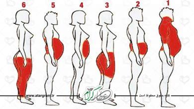 چاقی و اضافه وزن چه علتی دارد؟