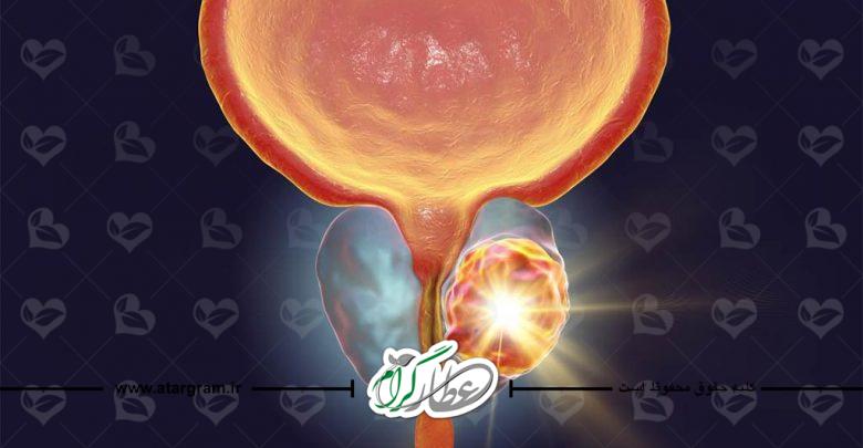 پروستات
