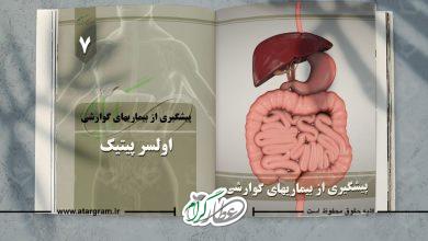 دلایل زخم معده در دستگاه گوارشی