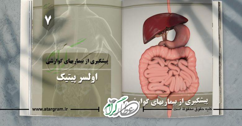 دلایل زخم معده در دستگاه گوارشی