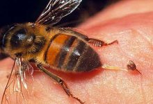 درمان کرونا و ام اس با زهر زنبور عسل