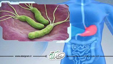 التهاب معده