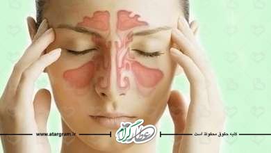 نزله چیست ؟