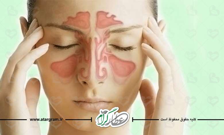 نزله چیست ؟