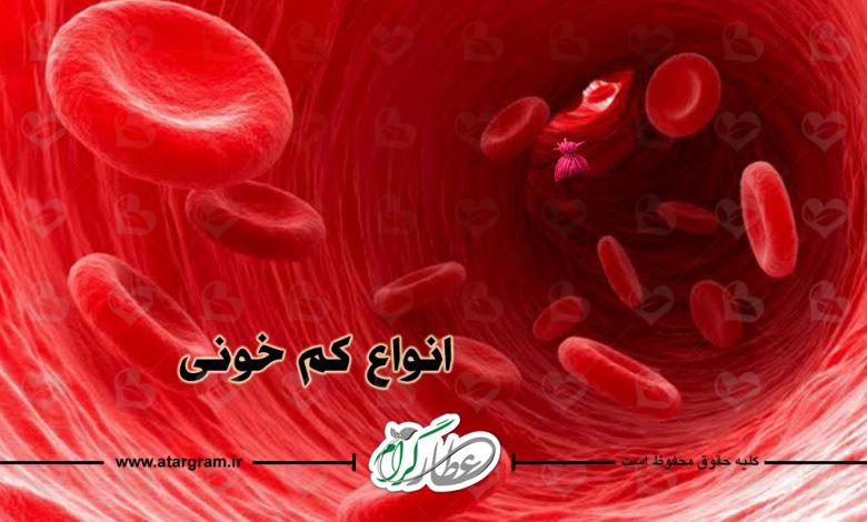 انواع کم خونی
