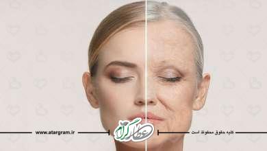 رفع چین و چروک صورت
