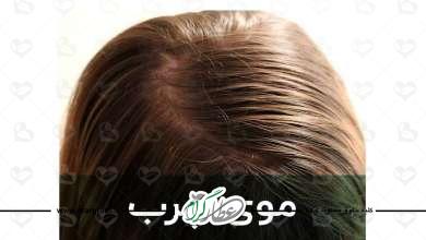 دلایل و علت چربی مو در طب سنتی