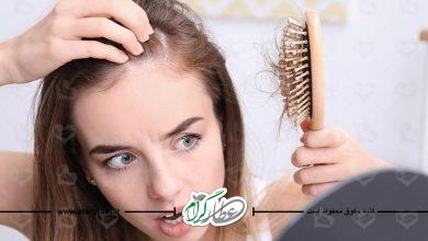 علت ریزش مو چیست؟