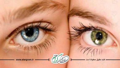 مراقبت چشم ها