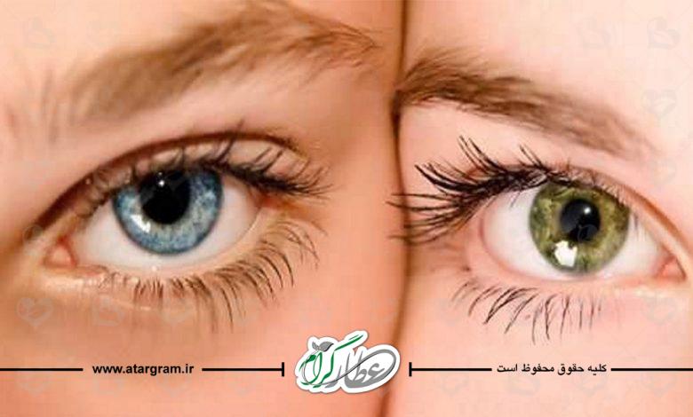 مراقبت چشم ها