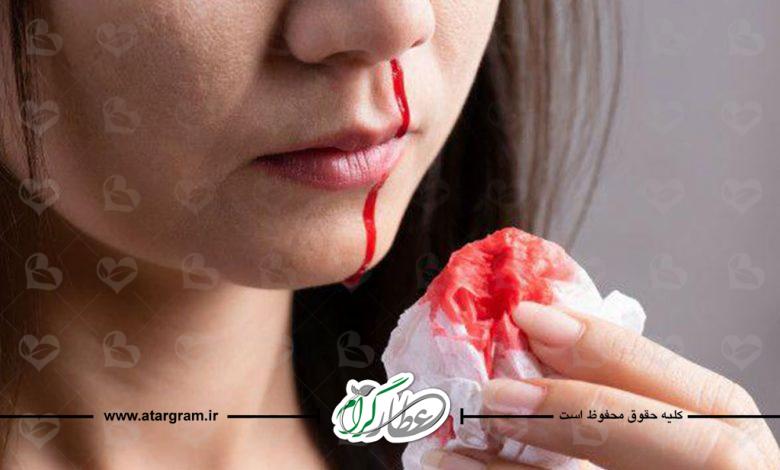 خونریزی بینی چیست؟