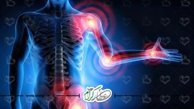 درمان التهاب در طب سنتی