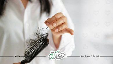 علت ریزش مو