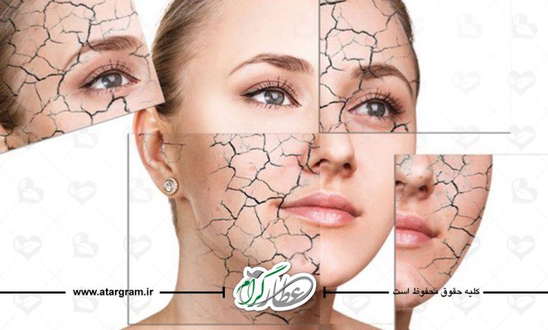 راهکار درمان و رفع بیماری خشکی پوست در طب سنتی