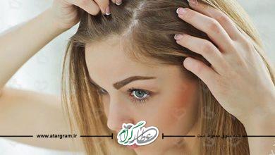 روش های درمان خانگی بیماریهای مو در طب سنتی