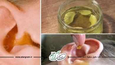 درمان گرفتگی گوش با طب سنتی و علت آن