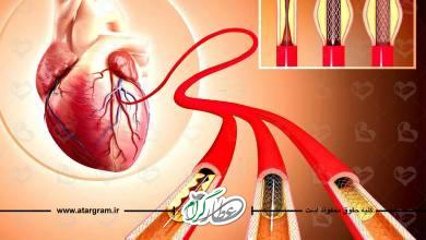 درمان و پیشگیری خانگی گرفتگی عروق قلبی با طب سنتی