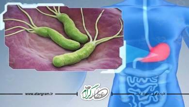 علت و علائم میکروب معده